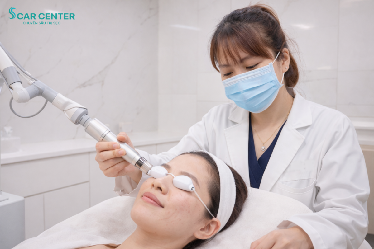 Laser Fractional CO2 trị sẹo lõm