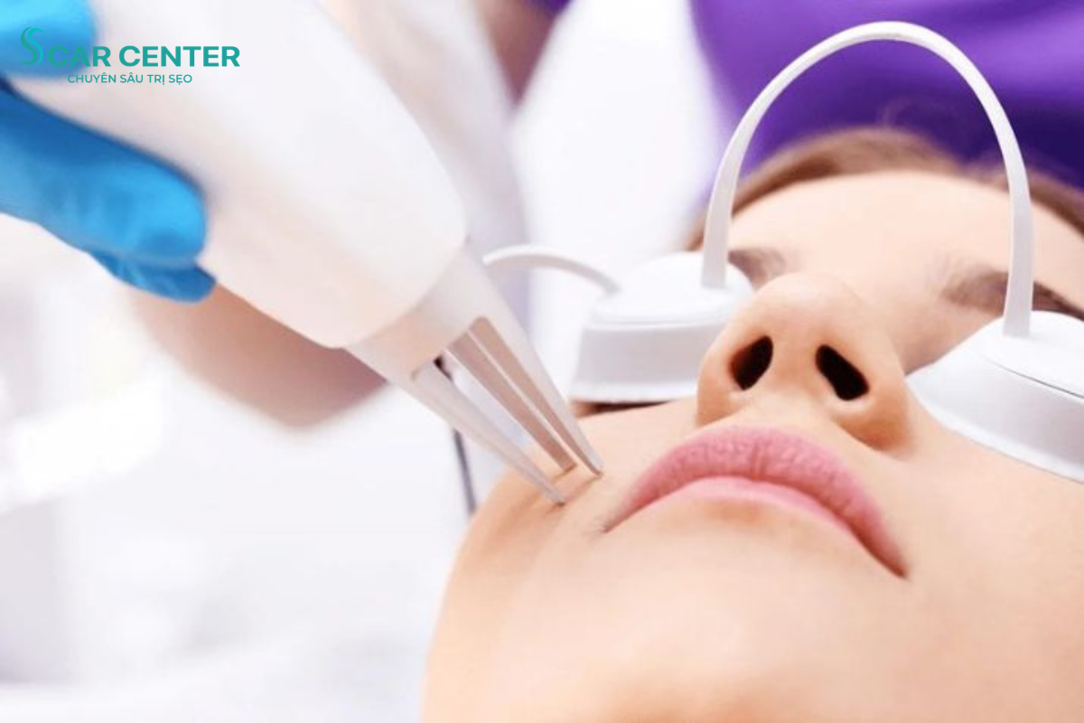 Laser Fractional CO₂ Trị Sẹo Rỗ Và Làm Sáng Da