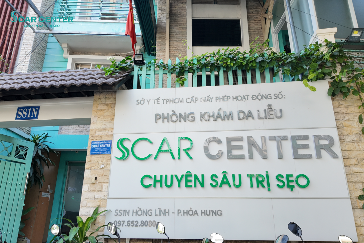 trị sẹo lồi ở đâu tốt