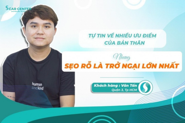 Hiệu quả điều trị sẹo rỗ