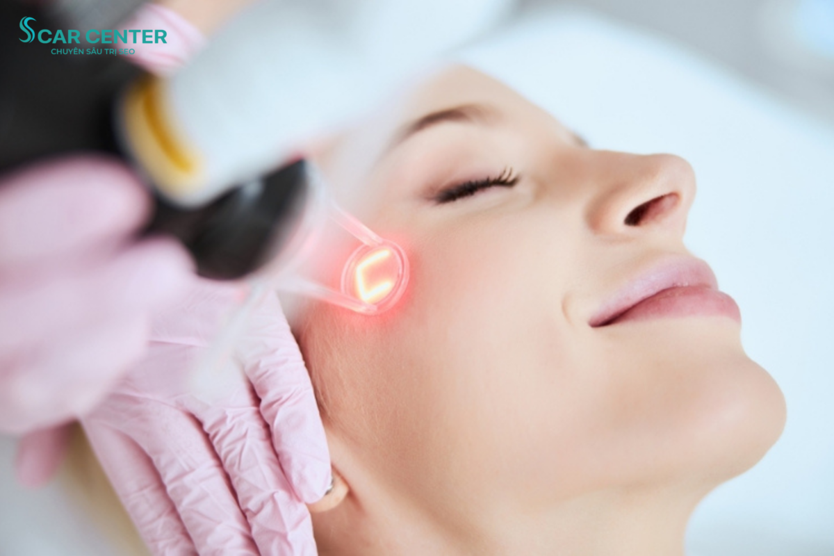 laser fractional co₂ tri seo ro 2
