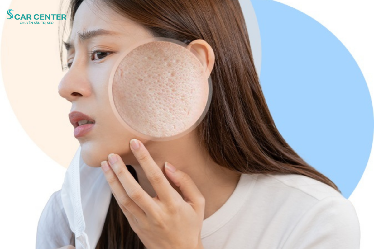 Trị sẹo rỗ có đau không