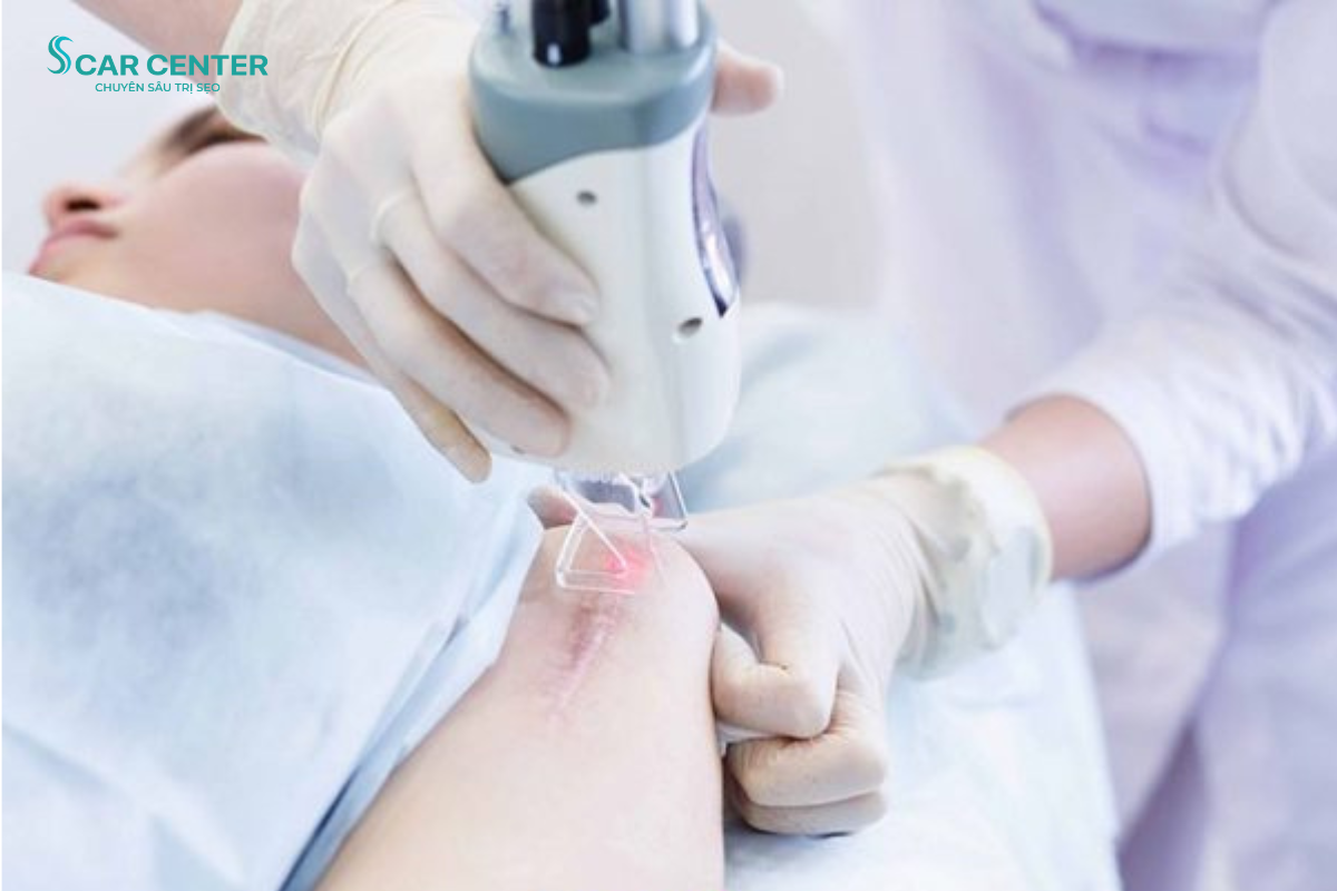 Điều trị sẹo tai nạn bằng Laser: Giải pháp cải thiện sẹo an toàn và hiệu quả