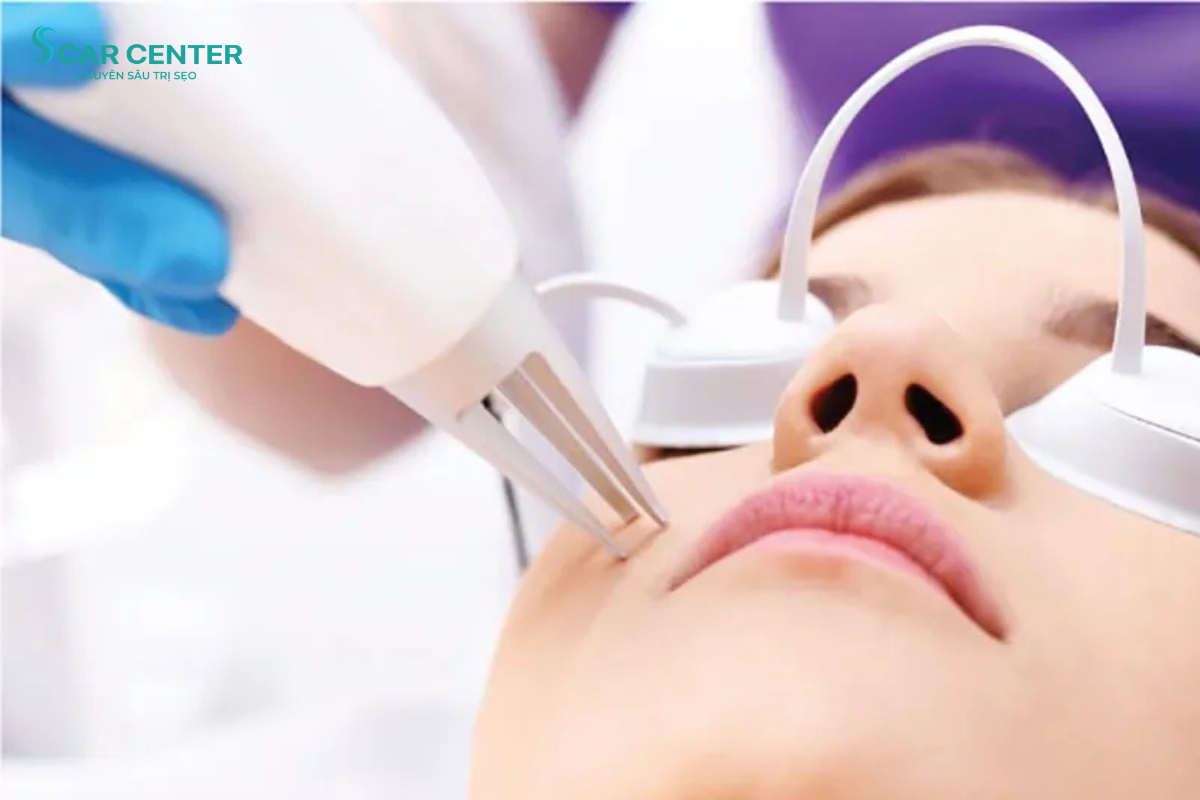 LASER TRẺ HÓA DA VÀ NHỮNG ĐIỀU CẦN BIẾT