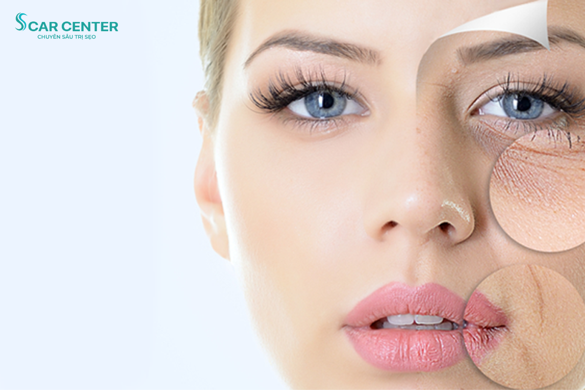 LASER TRẺ HÓA DA VÀ NHỮNG ĐIỀU CẦN BIẾT