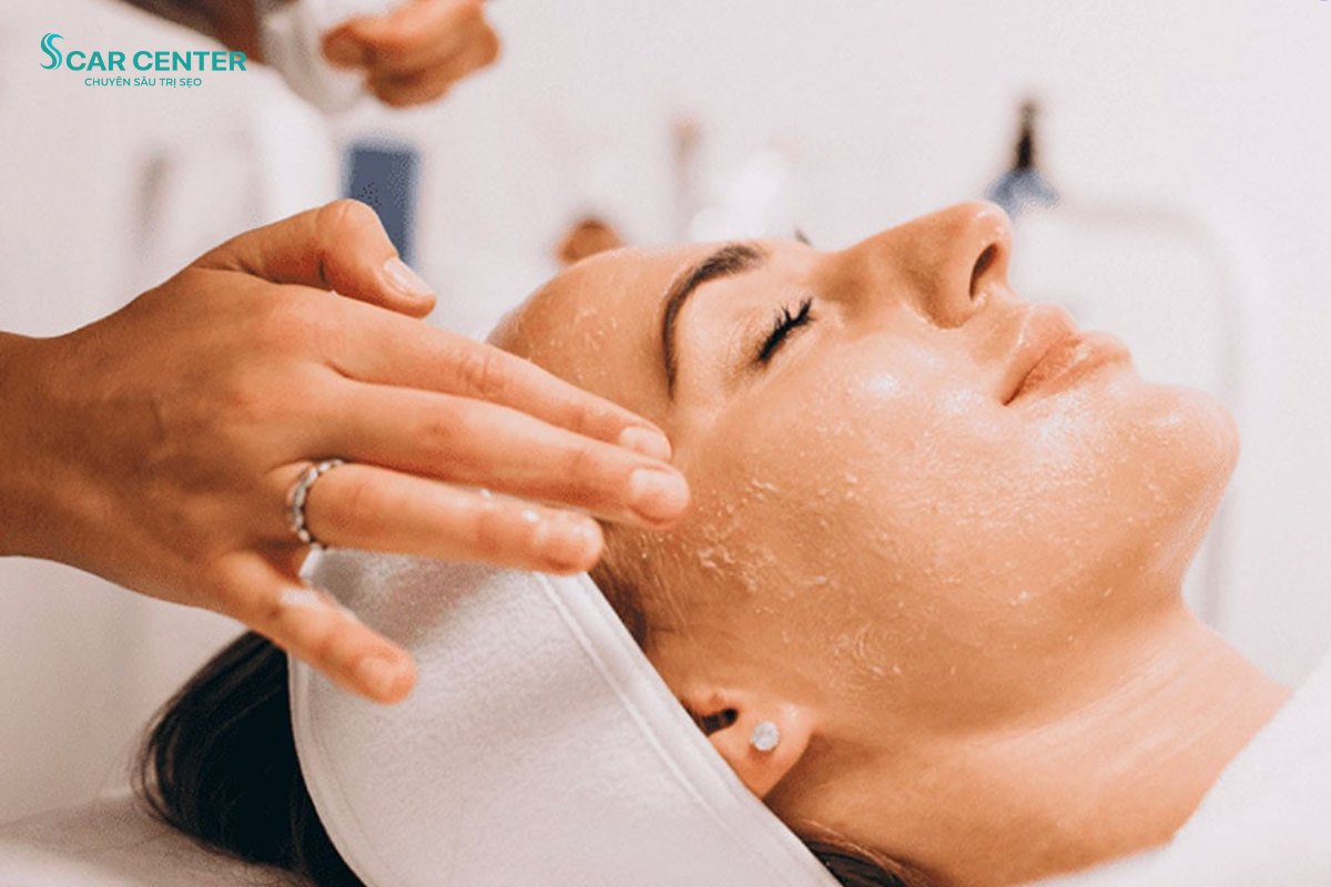 Peel điều trị da mụn: Giải pháp kiểm soát mụn hiệu quả