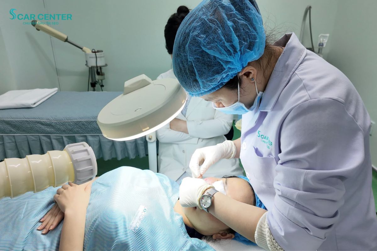Bác sĩ CKI Da liễu trực tiếp thăm khám và thực hiện thủ thuật bóc tách sẹo rỗ chuyên sâu cho khách hàng tại Scar Center