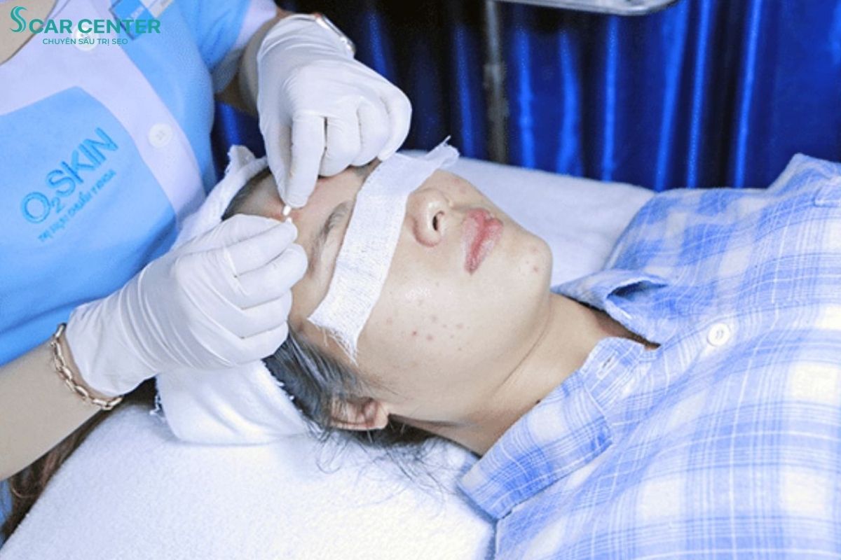 Phòng khám Da liễu O2 SKIN là địa chỉ điều trị sẹo rỗ uy tín với bảng giá niêm yết minh bạch