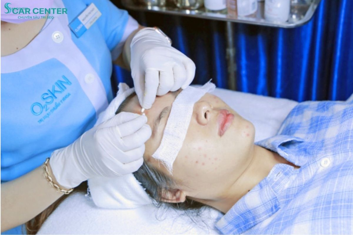 Phòng khám Da liễu O2 SKIN là địa chỉ điều trị sẹo rỗ uy tín với bảng giá niêm yết minh bạch