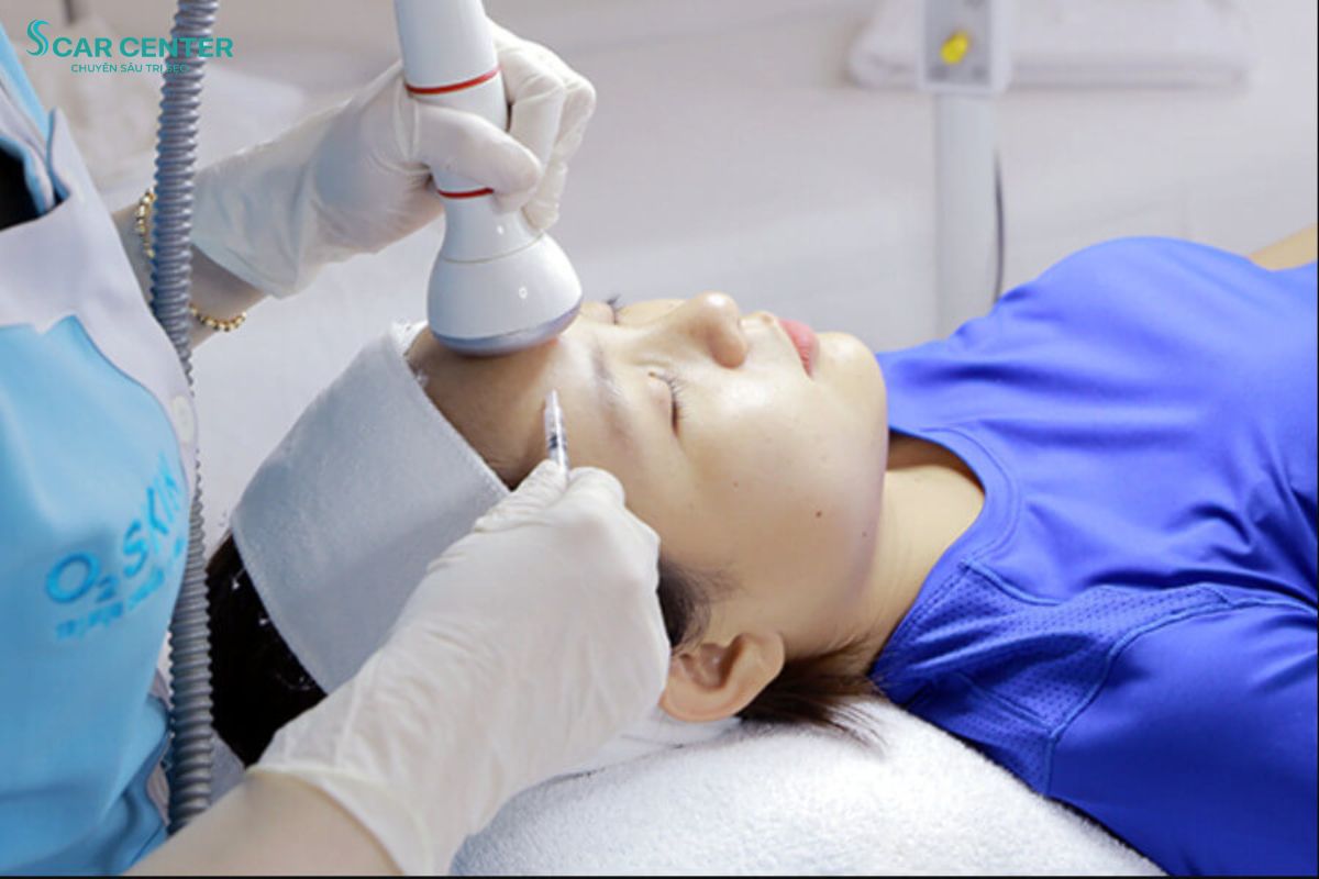 O2 SKIN điều trị sẹo rỗ theo lộ trình rõ ràng