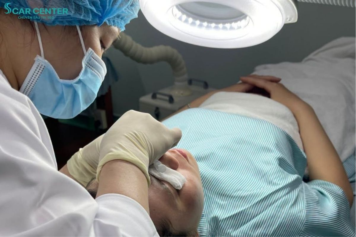 Scar Center niêm yết công khai chi phí trị sẹo giúp khách hàng dễ dàng tham khảo