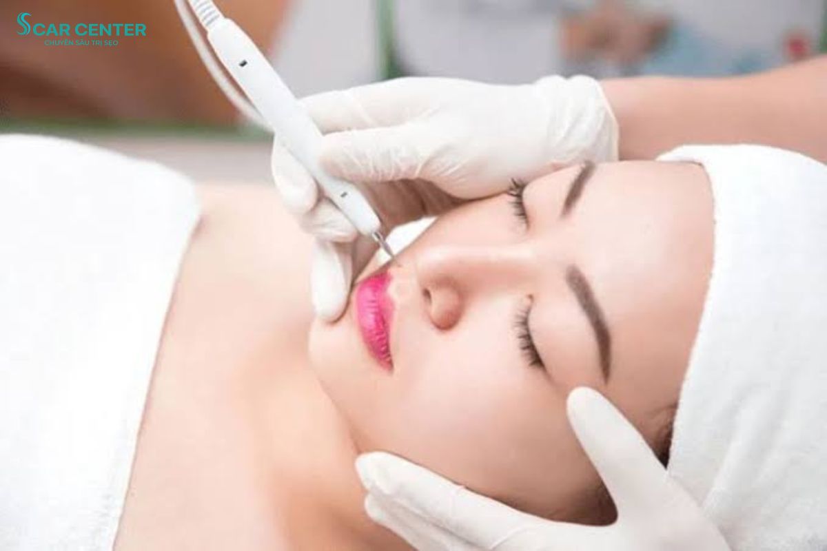 Dr. Choice nổi bật với kỹ thuật bóc tách dải xơ Cannula chuyên sâu