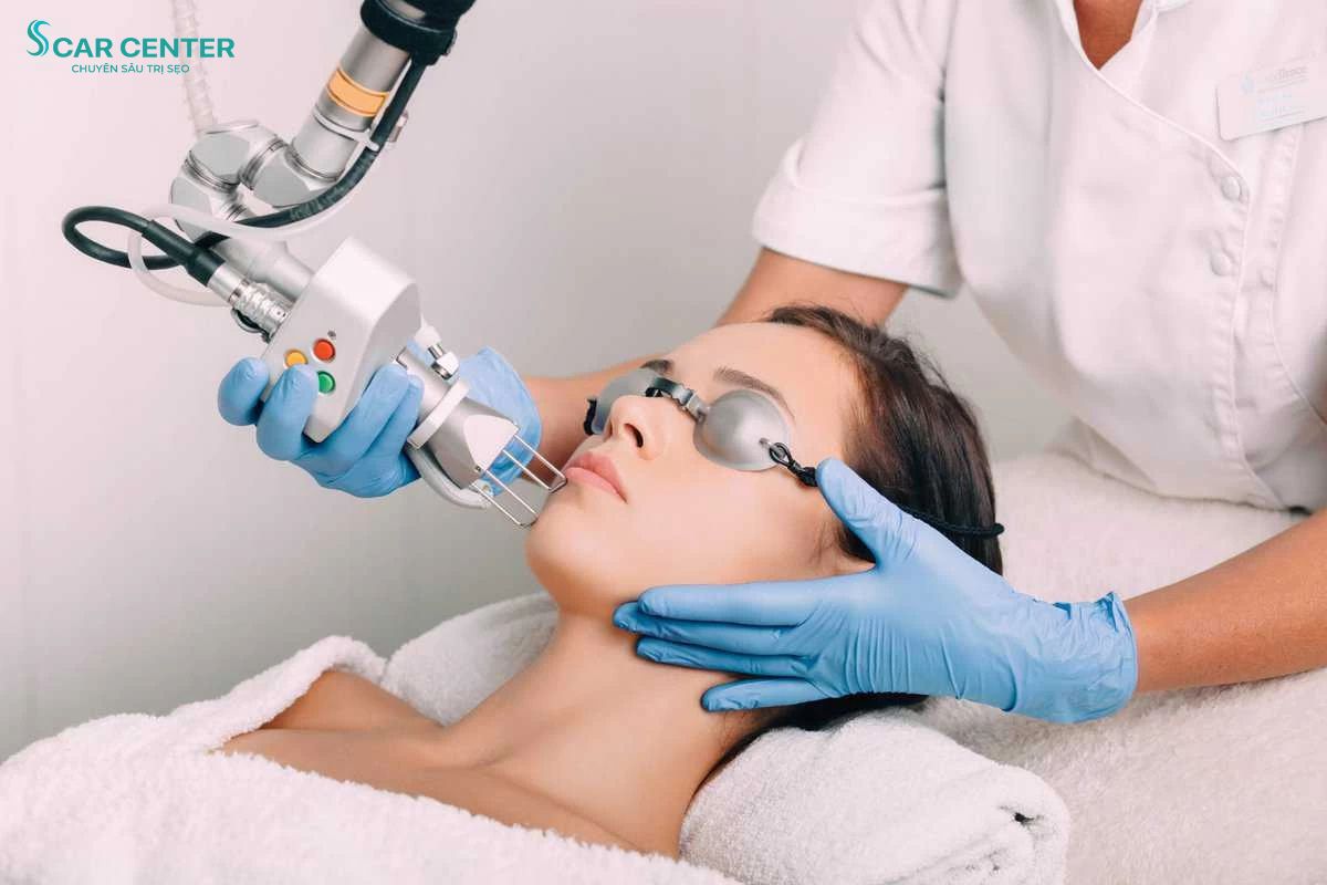 Tác động nhiệt vi điểm từ Laser CO2 và vi kim RF hỗ trợ kích thích tăng sinh Collagen
