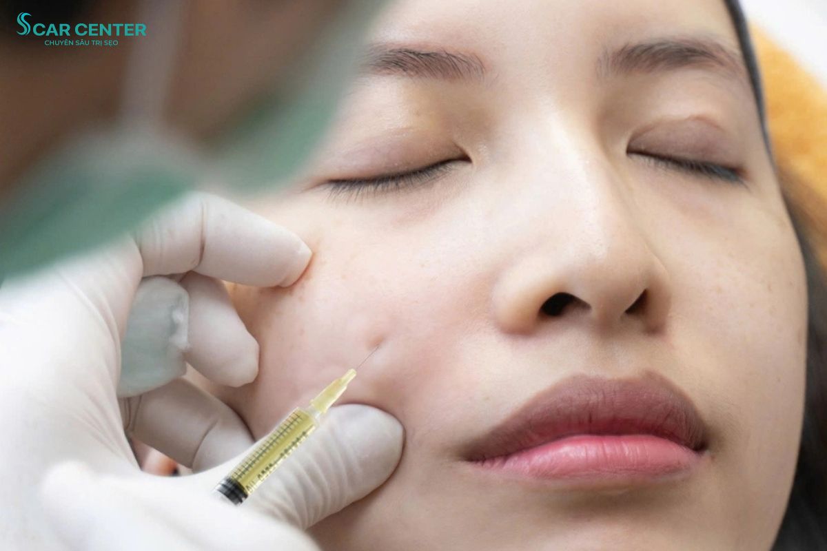 Kỹ thuật tiêm cấy dưỡng chất tầng sâu và yếu tố tăng trưởng tự thân giúp đẩy nhanh tốc độ lành thương