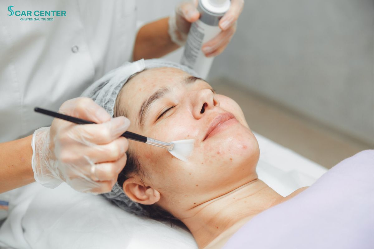 Chọn địa chỉ trị sẹo uy tín giúp bảo vệ làn da, điều trị thành công